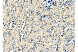 ABIN6262242 and ABIN6278080 at 1/100 staining Mouse kidney tissue by IHC-P. (HIPK2 Antikörper  (N-Term))