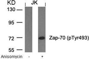 Western blot analysis of extracts from JK cells untreated or treated with anisomycin using Zap-70(Phospho-Tyr493) Antibody. (ZAP7 (pTyr493) Antikörper)