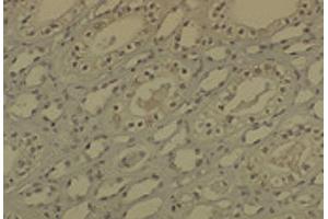 Immunohistochemistry analysis using Mouse Anti-DNMT1 Monoclonal Antibody, Clone 60B1220. (DNMT1 Antikörper  (AA 637-650) (Biotin))