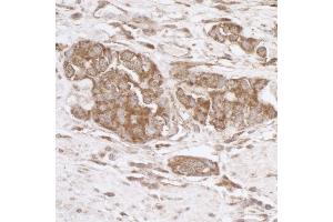 Immunohistochemistry (IHC) image for anti-TNF Receptor-Associated Protein 1 (TRAP1) (AA 600-650) antibody (ABIN7455063) (TRAP1 Antikörper  (AA 600-650))