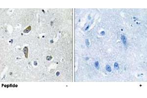 Immunohistochemistry analysis of paraffin-embedded human brain tissue using CDK5RAP2 polyclonal antibody . (CDK5RAP2 Antikörper)