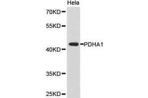Western Blotting (WB) image for anti-Pyruvate Dehydrogenase (Lipoamide) alpha 1 (PDHA1) antibody (ABIN1874077) (PDHA1 Antikörper)