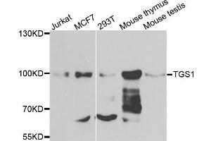 Western blot analysis of extracts of various cells, using TGS1 antibody. (TGS1 Antikörper)