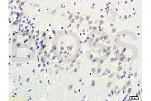 Formalin-fixed and paraffin-embedded : rat brain tissue labeled withRabbit Anti-TGM3 Polyclonal Antibody , Unconjugated, 1:200 followed by conjugation to the secondary antibody (TGM3 Antikörper  (AA 601-693))