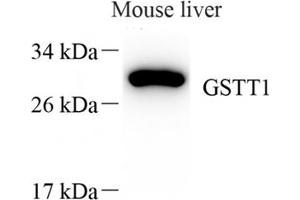 Western blot analysis of GSTT1 (ABIN7074091),at dilution of 1: 1000