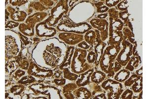 ABIN6279088 at 1/100 staining Human kidney tissue by IHC-P. (ADAMTS17 Antikörper)