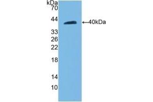 Detection of Recombinant CDH5, Rat using Polyclonal Antibody to Cadherin 5 (CDH5) (Cadherin 5 Antikörper  (AA 59-382))