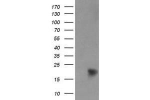 Image no. 8 for anti-NADH Dehydrogenase (Ubiquinone) 1 beta Subcomplex, 9, 22kDa (NDUFB9) (AA 3-179) antibody (ABIN1491360) (NDUFB9 Antikörper  (AA 3-179))
