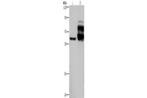 Western Blotting (WB) image for anti-Proprotein Convertase Subtilisin/kexin Type 9 (PCSK9) antibody (ABIN2435166) (PCSK9 Antikörper)