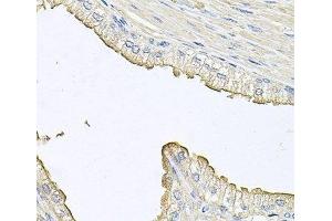 Immunohistochemistry of paraffin-embedded Human prostate using FABP12 Polyclonal Antibody at dilution of 1:100 (40x lens).