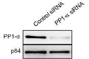 WB Image WB to detect PP1 alpha from U2OS cells treated with control siRNA or PP1 alpha siRNA, using  at 1:1000 dilution. (PPP1CA Antikörper  (Center))