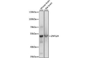 Western blot analysis of extracts of various cell lines, using ZNF124 antibody. (ZNF124 Antikörper)