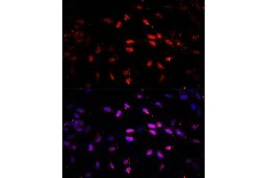 Immunofluorescence analysis of NIH/3T3 cells using KDM6B antibody (ABIN6131823, ABIN6142806, ABIN6142809 and ABIN6216507) at dilution of 1:100. (Kdm6b Antikörper  (AA 265-450))