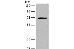 Western blot analysis of Jurkat cell lysate using ADGRE3 Polyclonal Antibody at dilution of 1:550 (EMR3 Antikörper)