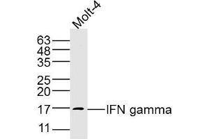 Image no. 5 for anti-Interferon gamma (IFNG) (AA 81-166) antibody (ABIN669141)