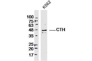 Lane 1: K562 lysates probed with CTH Polyclonal Antibody, Unconjugated  at 1:300 overnight at 4˚C. (CTH Antikörper)