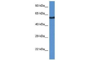 Western Blot showing CAMK2B antibody used at a concentration of 1 ug/ml against THP-1 Cell Lysate (CAMK2B Antikörper  (Middle Region))