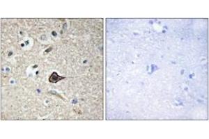 Immunohistochemistry analysis of paraffin-embedded human brain, using TNF12 Antibody. (TWEAK Antikörper  (AA 41-90))