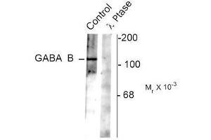 Image no. 1 for anti-gamma-aminobutyric Acid (GABA) B Receptor, 2 (GABBR2) (pSer783) antibody (ABIN372643) (GABBR2 Antikörper  (pSer783))
