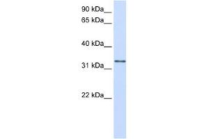 GPSN2 antibody used at 1 ug/ml to detect target protein. (TECR Antikörper  (C-Term))