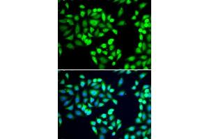 Immunofluorescence analysis of A-549 cells using SGTA antibody. (SGTA Antikörper  (AA 1-120))