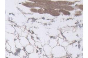 IHC-P analysis of Mouse Skin Tissue, with DAB staining. (Filaggrin Antikörper  (AA 119-336))