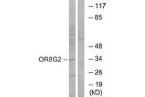Western blot analysis of extracts from HT-29 cells, using OR8G2 Antibody. (OR8G2 Antikörper  (AA 237-286))