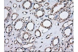 Immunohistochemical staining of paraffin-embedded Human Kidney tissue using anti-TBXAS1 mouse monoclonal antibody. (TBXAS1 Antikörper)