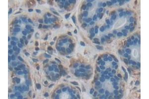 Immunohistochemistry (IHC) image for anti-Fas Ligand (TNF Superfamily, Member 6) (FASL) antibody (ABIN7439063)