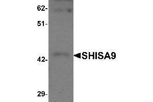 Western Blotting (WB) image for anti-Shisa Homolog 9 (Shisa9) (Middle Region) antibody (ABIN1031091) (Shisa9 Antikörper  (Middle Region))