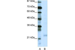 Human Jurkat; WB Suggested Anti-TAF10 Antibody Titration: 0. (TAF10 Antikörper  (C-Term))