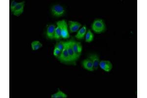 Immunofluorescence staining of MCF-7 cells with ABIN7168026 at 1:66, counter-stained with DAPI. (RHOD Antikörper  (AA 1-80))
