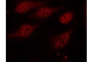 Immunofluorescence staining of methanol-fixed Hela cells, using Phospho-TP53-S315 antibody. (p53 Antikörper  (pSer315))