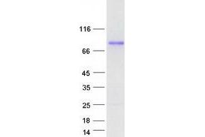 Western Blotting (WB) image for rho GTPase Activating Protein 22 (ARHGAP22) protein (Myc-DYKDDDDK Tag) (ABIN2714876)