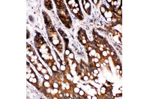 Immunohistochemistry (IHC) image for anti-Caspase 6, Apoptosis-Related Cysteine Peptidase (CASP6) (AA 7-27), (N-Term) antibody (ABIN5518670)