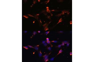 Immunofluorescence analysis of NIH/3T3 cells using CLDN5 antibody (ABIN6127705, ABIN6138692, ABIN6138693 and ABIN6214365) at dilution of 1:100. (Claudin 5 Antikörper  (AA 230-303))
