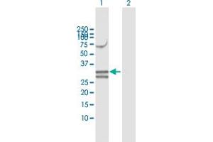 Western Blot analysis of NUDT6 expression in transfected 293T cell line by NUDT6 MaxPab polyclonal antibody. (NUDT6 Antikörper  (AA 1-316))