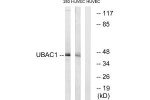 Western blot analysis of extracts from 293 cells and HUVEC cells, using UBAC1 antibody. (UBAC1 Antikörper  (Internal Region))