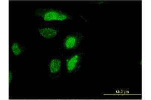 Immunofluorescence of monoclonal antibody to RDH12 on HeLa cell.