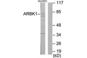 Western Blotting (WB) image for anti-Adrenergic, Beta, Receptor Kinase 1 (ADRBK1) (AA 601-650) antibody (ABIN2889434) (GRK2 Antikörper  (AA 601-650))