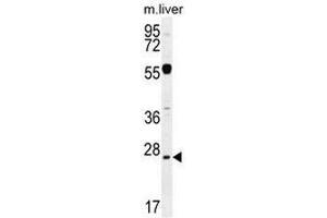 NPS3A Antibody (Center) western blot analysis in mouse liver tissue lysates (35µg/lane). (NIPSNAP3A Antikörper  (Middle Region))