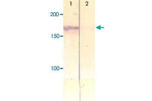 The cell lysate derived from insulin stimulated CHO was immunoprecipitated by IRS1 (phospho Y612) polyclonal antibody , then immunoprobed by the same antibody at 1 : 500 (Lane 1). (IRS1 Antikörper  (pTyr612))