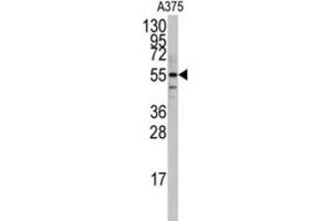 Western Blotting (WB) image for anti-Polymerase I and Transcript Release Factor (PTRF) antibody (ABIN3003202)