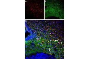 Multiplex staining of Parathyroid hormone receptor 1 and Orexin receptor 1 in rat ventromedial hypothalamus - Immunohistochemical staining of perfusion-fixed frozen rat brain sections using Anti-Orexin Receptor 1-ATTO Fluor-488 Antibody (ABIN7043286), (1:60) and Anti-PTH1R (extracellular) Antibody (ABIN7043429, ABIN7045112 and ABIN7045113), (1:60). (PTH1R Antikörper  (Extracellular))