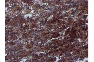 Image no. 5 for anti-Complement Component 1, S Subcomponent (C1S) antibody (ABIN1497565) (C1S Antikörper)