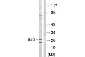 Western blot analysis of extracts from mouse liver cells, using BAD (Ab-134) Antibody. (BAD Antikörper  (AA 100-149))