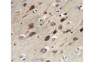 IHC analysis of FFPE human brain stained with BDNF antibody (BDNF Antikörper  (AA 206-236))