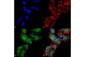 Immunocytochemistry/Immunofluorescence analysis using Rabbit Anti-Calcium Sensing Receptor Polyclonal Antibody . (CASR Antikörper  (AA 1-100) (HRP))