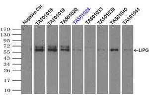 Image no. 1 for anti-Lipase, Endothelial (LIPG) antibody (ABIN1499166) (LIPG Antikörper)