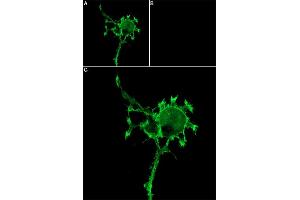 Unlabeled α-Bungarotoxin successfully blocks nicotinic ACh channels access.